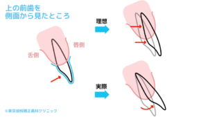 上の前歯を側面から見たところ