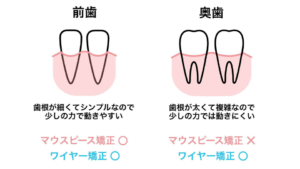 歯の根が細くてシンプルなので少しの力で動く前歯はマウスピース矯正に向いている。奥歯は歯根が太くて複雑なので少しの力では動きにくい。