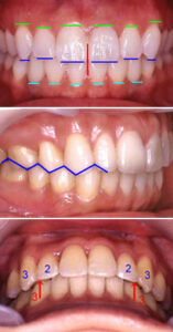 occlusion_health