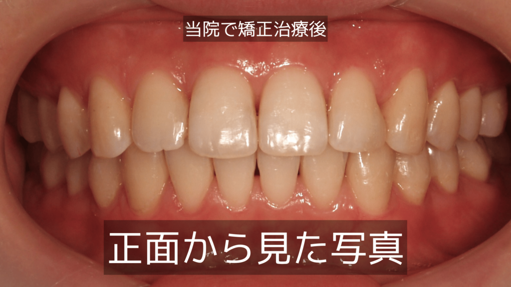 矯正歯科医が考える理想の噛み合わせとは