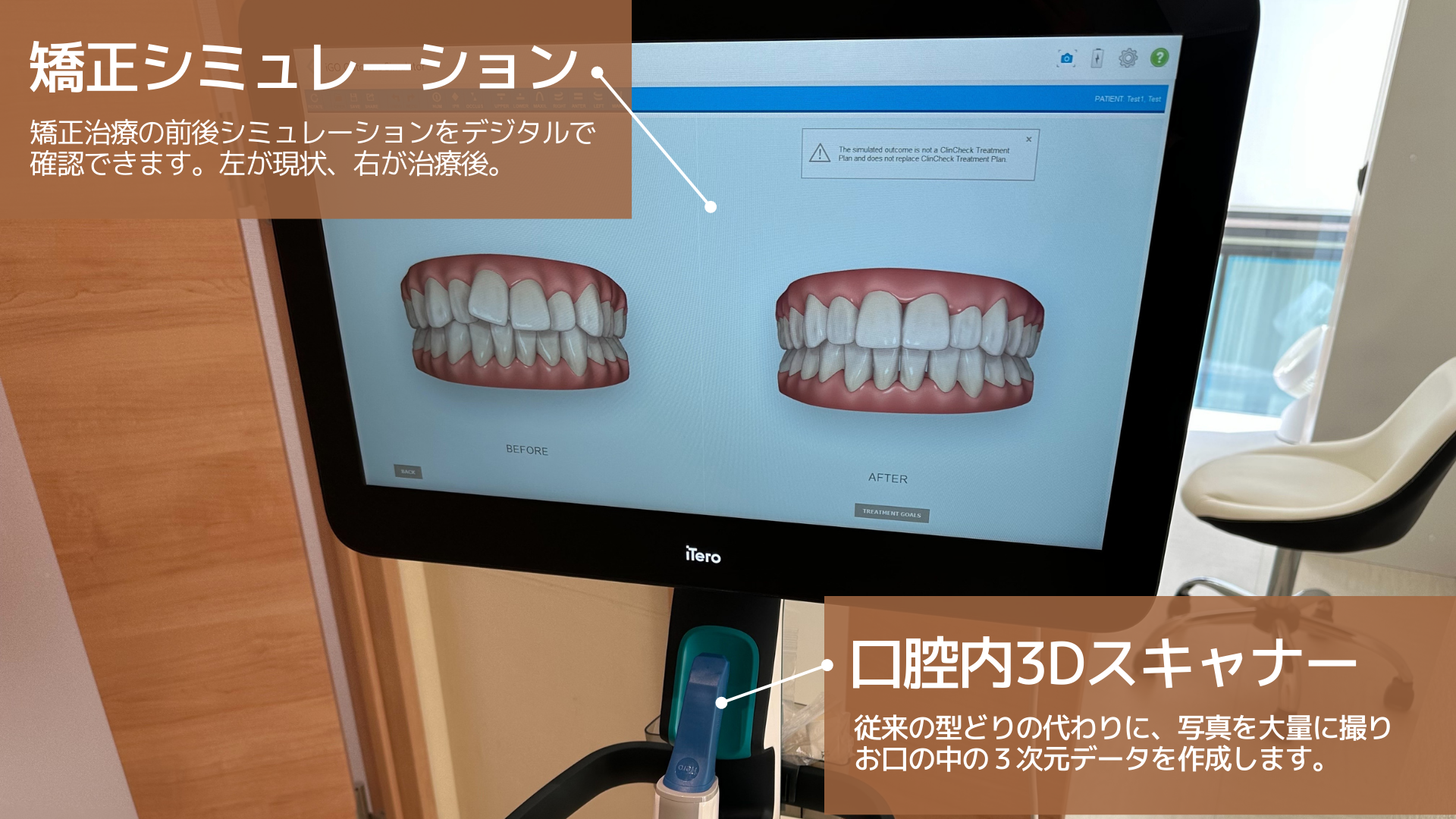 インビザラインの矯正シミュレーションと口腔内3Dスキャナー
