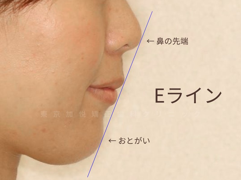 ポイント7 上下の唇を軽く合わせて、横から見た時