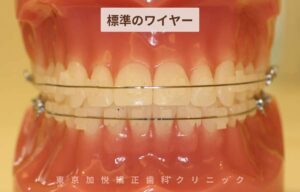 標準のワイヤー