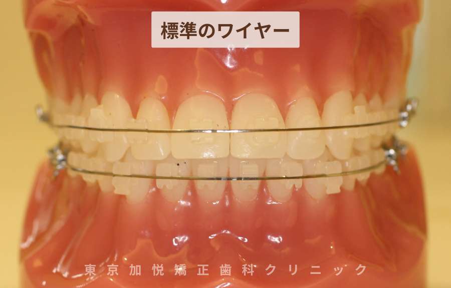 標準のワイヤー
