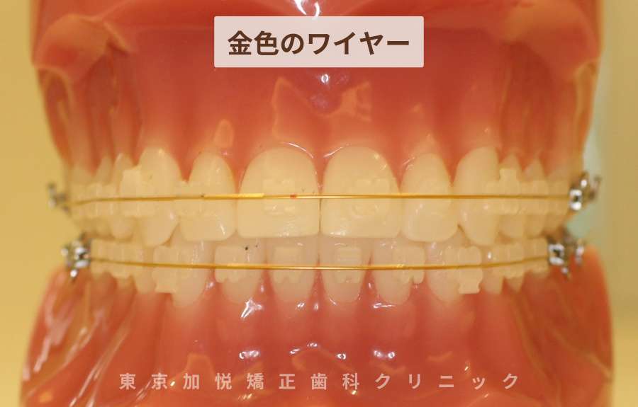 金色のワイヤー