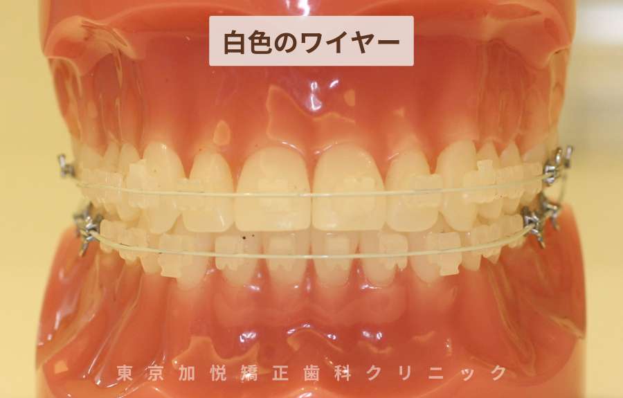 白色のワイヤー