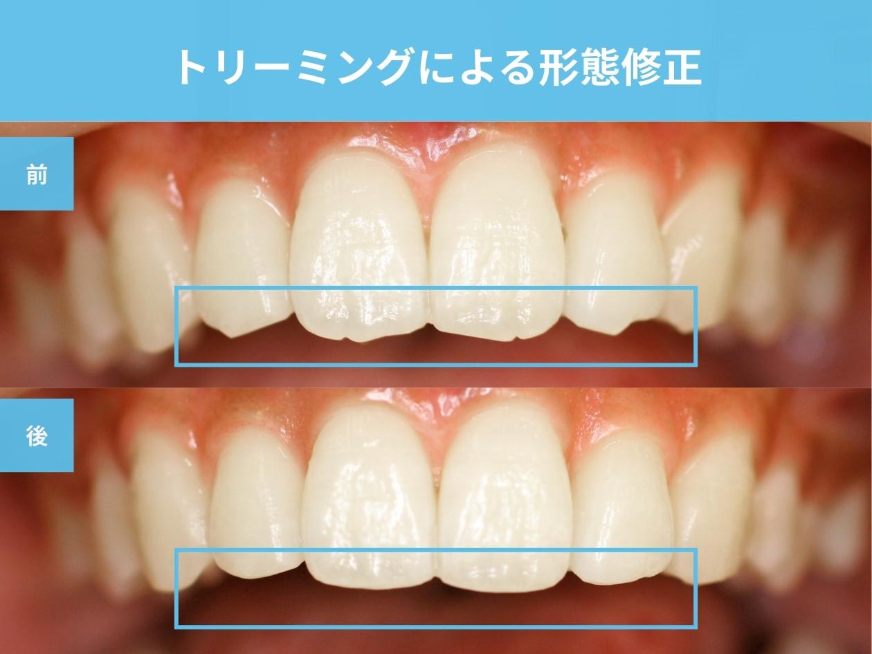 トリーミングによる形態修正