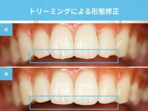 トリーミングによる形態修正